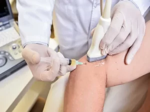 تزریق prp در ارتوپدی
