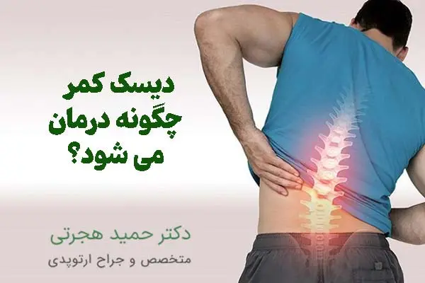 بهترین درمان دیسک کمر در مشهد چیست؟