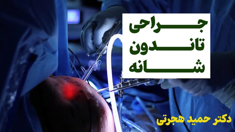 نحوه عمل پارگی تاندون شانه