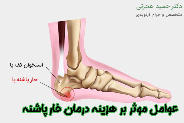 عوامل موثر بر هزینه درمان خارپاشنه