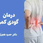 انواع روش های درمان گودی کمر