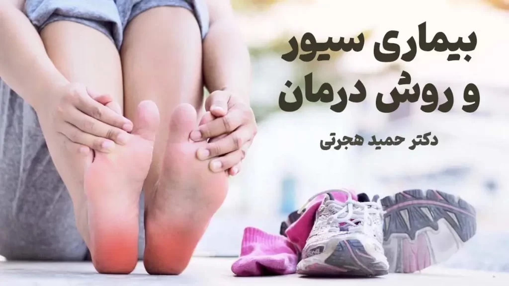 بیماری سیور و روش درمان