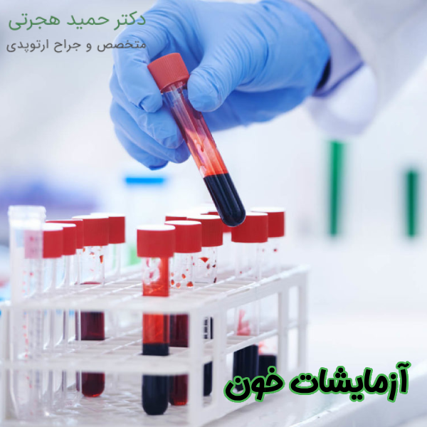 آزمایشات خون