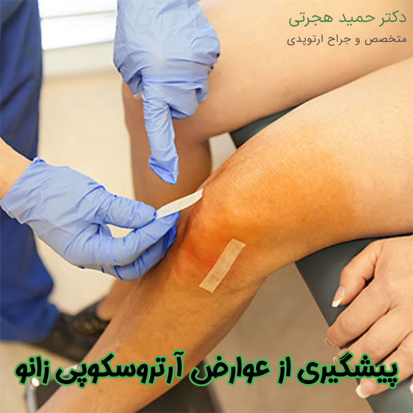 پیشگیری از عوارض آرتروسکوپی زانو