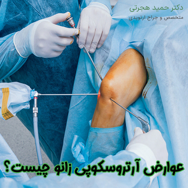 عوارض جراحی آرتروسکوپی زانو