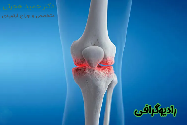 رادیوگرافی