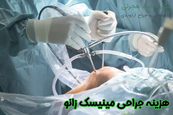 هزینه عمل مینیسک زانو