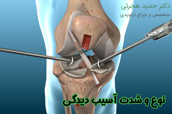 نوع و شدت آسیب‌ دیدگی