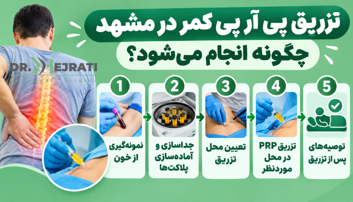 تزریق پی آر پی کمر در مشهد چگونه انجام میشود؟