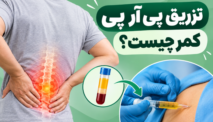 تزریق پی آر پی کمر چیست؟