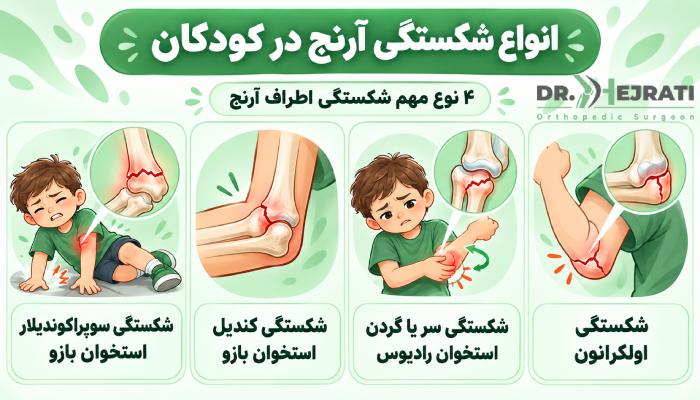 انواع شکستگی آرنج در کودکان