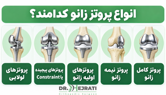 انواع پروتز زانو کدامند؟