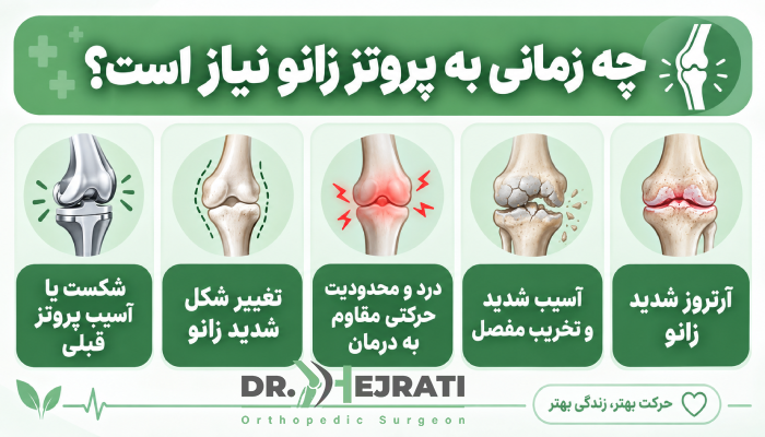 چه زمانی به پروتز زانو نیاز است؟